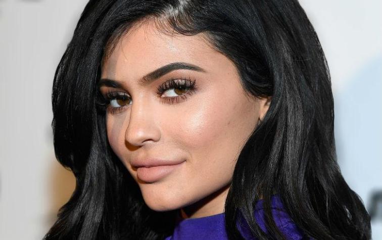 La historia tras la enorme cicatriz que Kylie Jenner tiene en la pierna