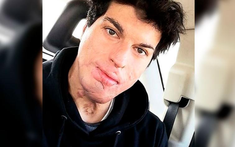 Ignacio Lastra muestra su six pack en redes sociales