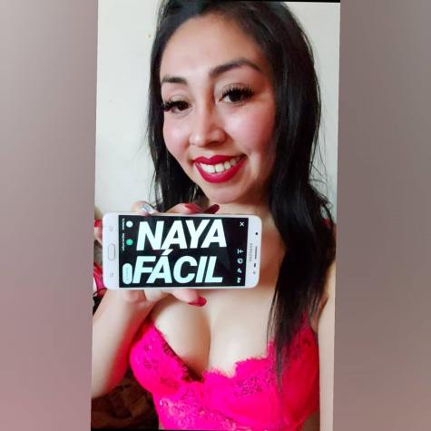 Naya Fácil muestra su “antes” y “después” de su rinoplastia