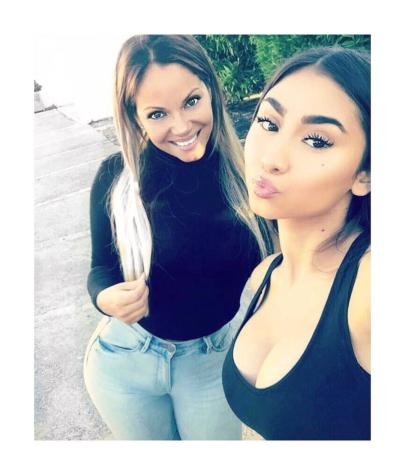 Tía de Paloma Mami confiesa que casi pierde la vida por cirugía estética