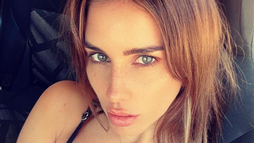 "Parece un dibujo animado": seguidores de Fran Undurraga le piden que deje los filtros en sus fotos