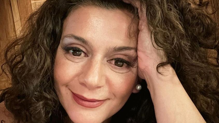 Paola Troncoso mostró cómo está su pelo luego de que se lo quemaran