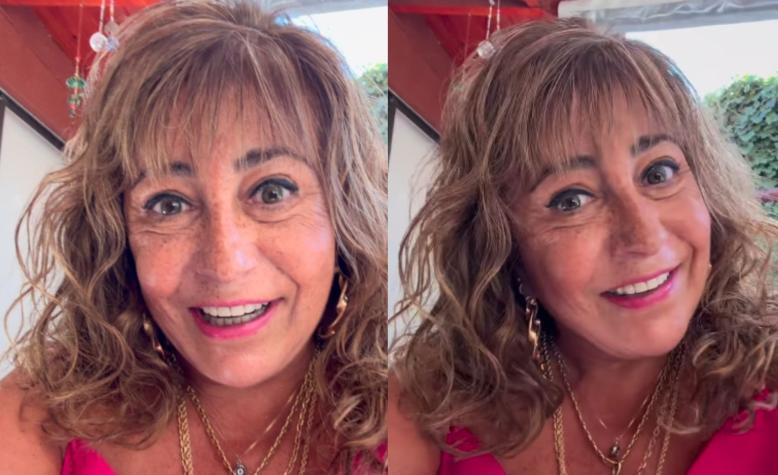 Helhue Sukni reveló nuevo retoque estético en su rostro