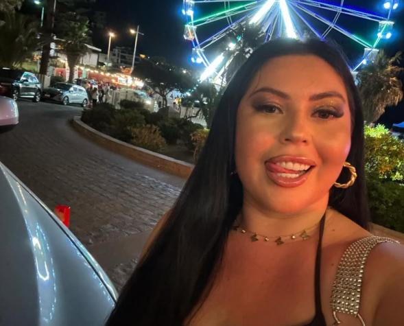Camila Arismendi intervino su rostro con cirugía estetica irreversible: “No fue fácil”