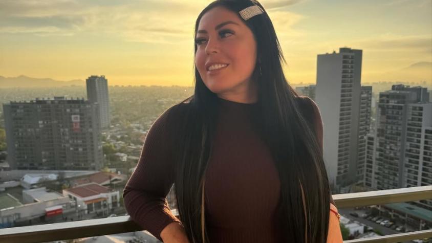 Camila Arismendi sorprende con nuevo tratamiento estético en su rostro y sus fans le piden parar