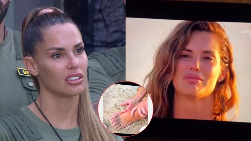 Gala Caldirola sufre accidente en reality Supervivientes España: mostraron cómo quedó su pie