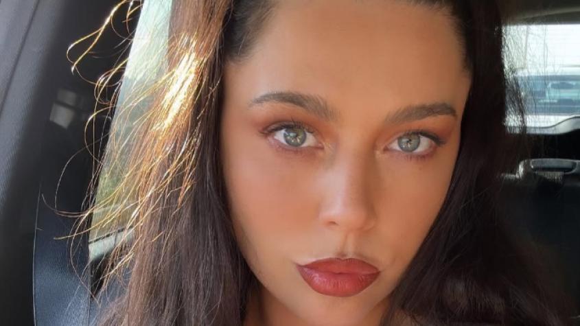 "Triángulo de belleza": Daniela Aránguiz mostró con lujo y detalle su nuevo procedimiento estético