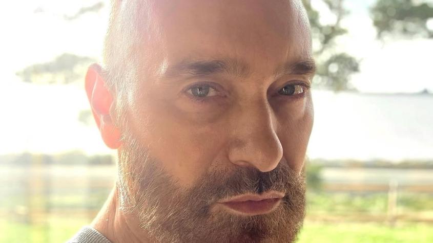 Jordi Castell se operó y habló de su primera vez con un bisturí en la cara: "No viene a rejuvenecer"