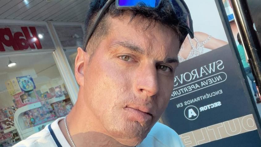 El nuevo giro en la vida de Ignacio Lastra a casi una década de haber sufrido accidente automovilístico: "Tenía miedo"