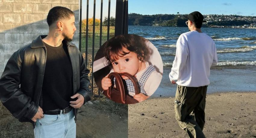 Influencer chileno muestra cómo avanza su transición de género tras importante cirugía