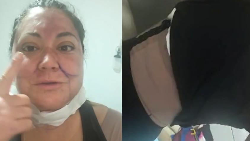 Denisse Campos impacta tras volver a trabajar a solo dos semanas de someterse a procedimiento estético