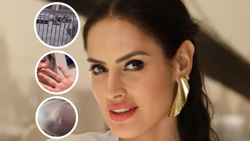  “Estoy con heridas”: Adriana Barrientos sufre violento portonazo y es trasladada a la clínica