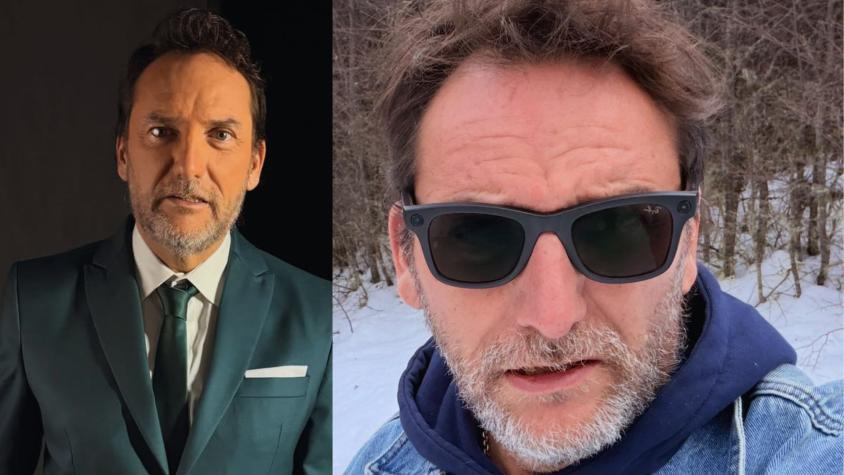 ¡Cambio de look total!: Daniel Fuenzalida se sometió a popular procedimiento estético