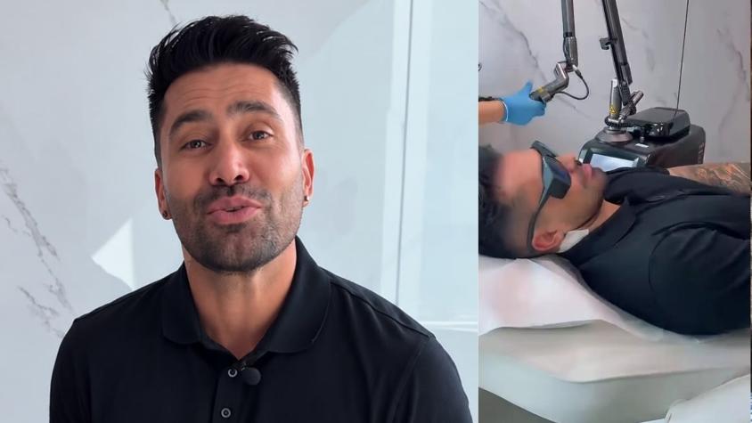 Luis Jiménez sorprende con decisión tras polémica: comenzó a borrar tatuaje dedicado a Coté López