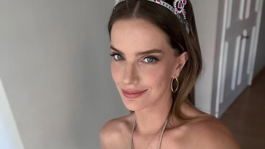 Millaray Viera se sincera sobre su enfermedad y revela el momento en que supo que algo no estaba bien: "Ya no era normal"