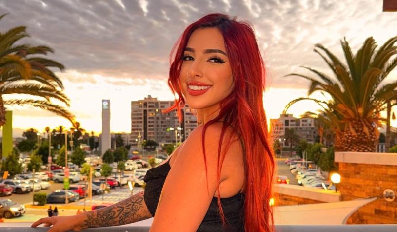 Chilota revela que deberá someterse a una cirugía tras accidente en su cumpleaños