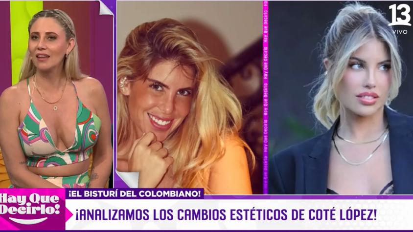 La sincera opinión de Gissella Gallardo sobre las operaciones de Coté López: "No sé por qué..."